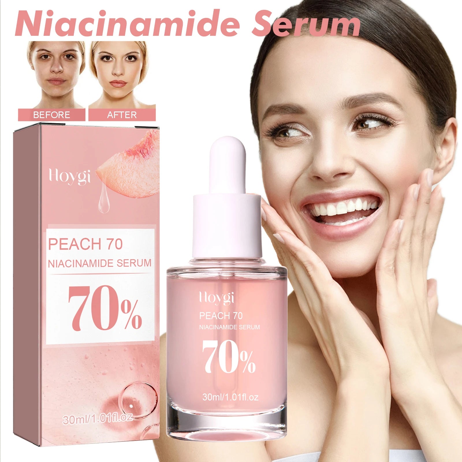 Niacinamide Facial Serum - Fade Melanin, Brighten Skin & Shrink Pores, Dark Spot Remover 150ml