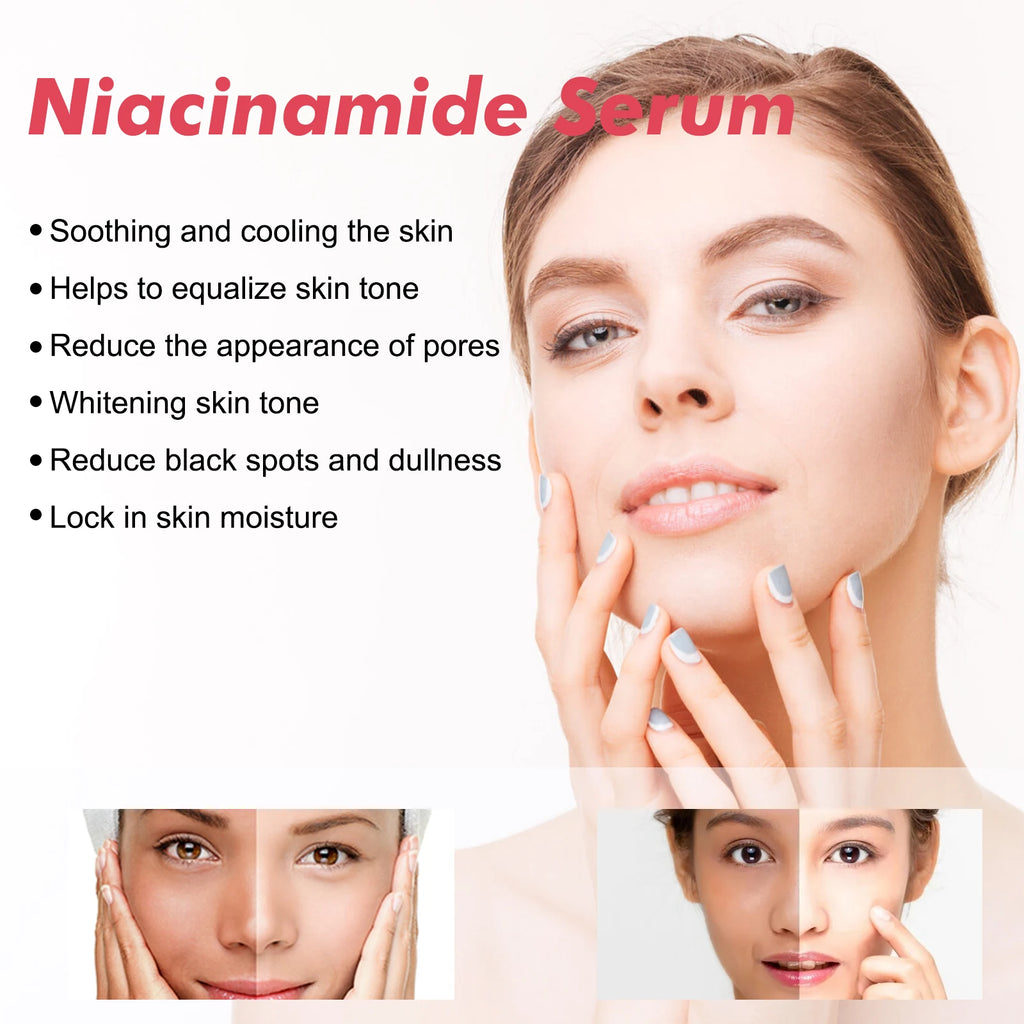 Niacinamide Facial Serum - Fade Melanin, Brighten Skin & Shrink Pores, Dark Spot Remover 150ml