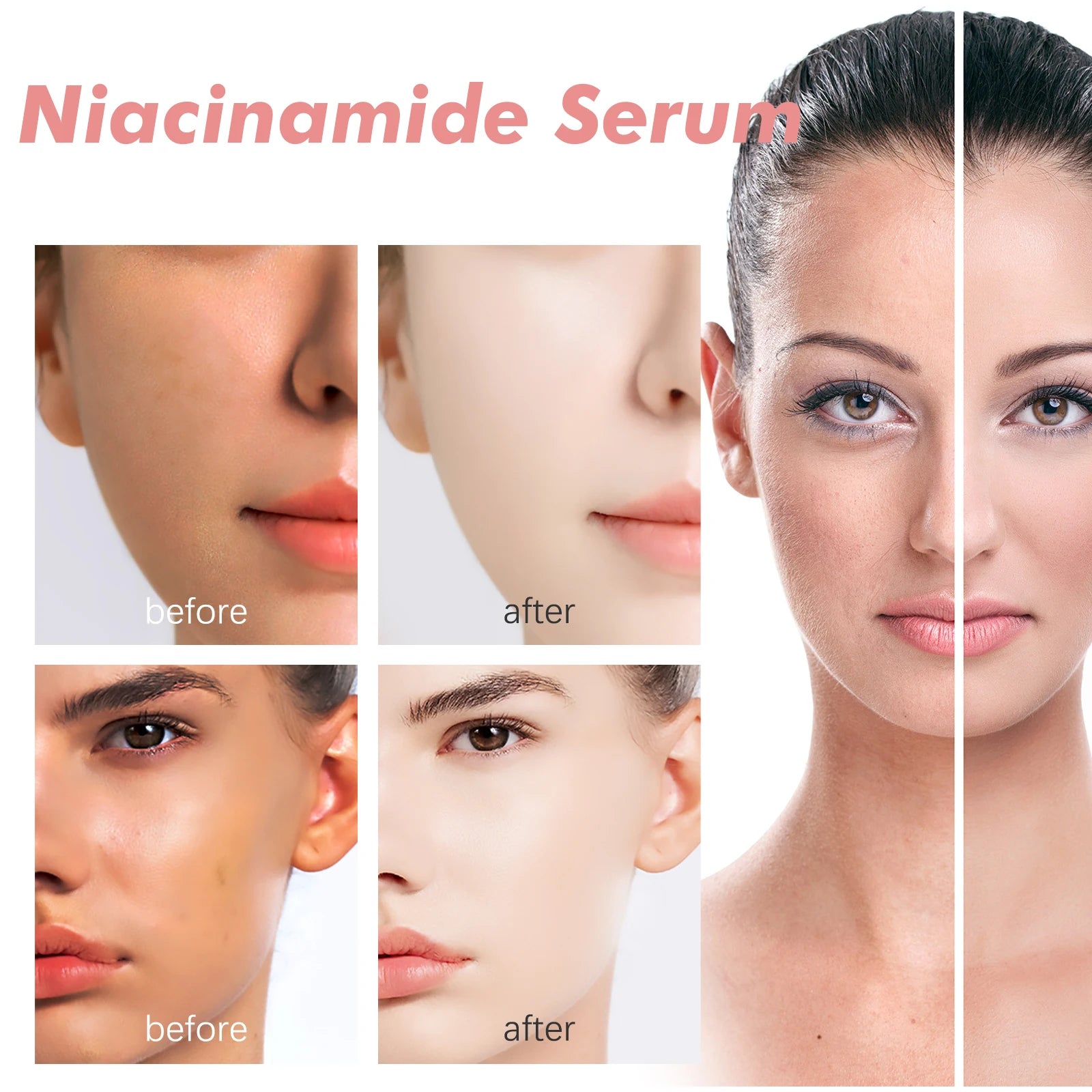Niacinamide Facial Serum - Fade Melanin, Brighten Skin & Shrink Pores, Dark Spot Remover 150ml
