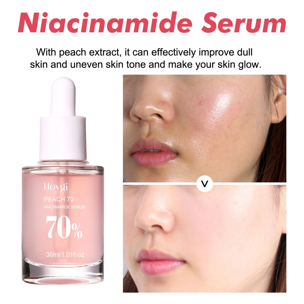 Niacinamide Facial Serum - Fade Melanin, Brighten Skin & Shrink Pores, Dark Spot Remover 150ml